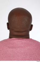  Photos Izik Wangombe  2 bald head 0001.jpg